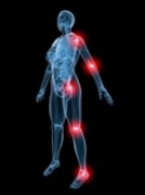 Some Classic Symptoms of Arthritis