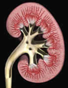 What's The First Step In Treating Kidney Stones?