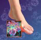 Home Remedy For Gout