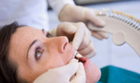 Professional Tooth Whitening