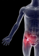 Information on Hip and Thigh Pain