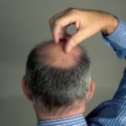 How to Treat Itching