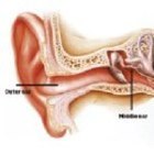 Think You've Got a Hearing Problem? Let Hearing Auckland Help