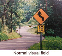 normal visual field
