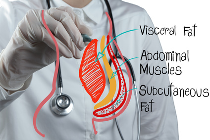doctor draws abdominal fat as medical concept