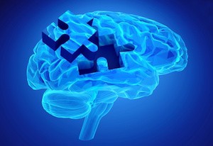 Human brain research and memory loss as symbol of alzheimer's concept with missing pieces of the puzzle